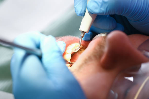 Best Chipped Tooth Repair Near Me  in Bay Village, OH